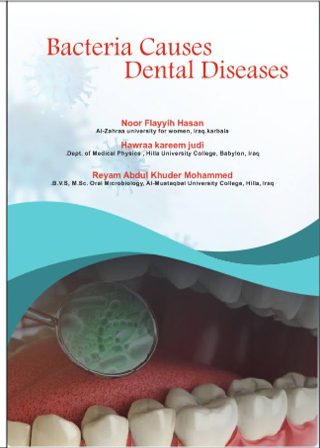 Bacteria Causes Dental Diseases