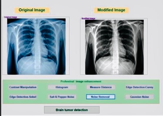 تحسين الصور الطبية بإستخدام الماتلاب 