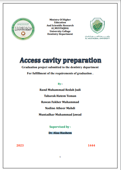 Access cavity preparation