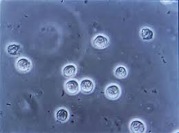 تم نشر مقاله علميه حديثه  بواسطة د.رواء ماجد محمد / مقرر قسم تقنيات التخدير بعنوانBacteriuria 