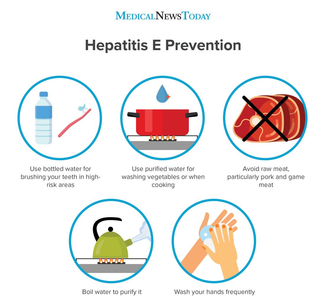 تم نشر مقالة علمية للتدريسية (رواء ماجد محمد) بعنوان Hepatitis Bed