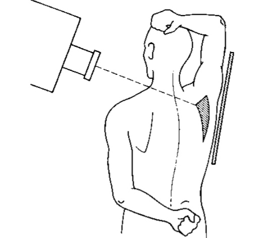 default image