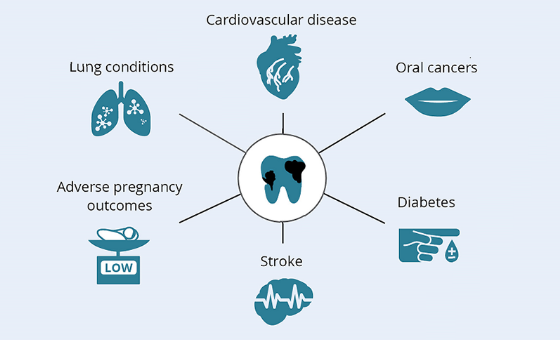 مقالة علمية م.م.محمد فارس بعنوان Dental Health and Lung Disease