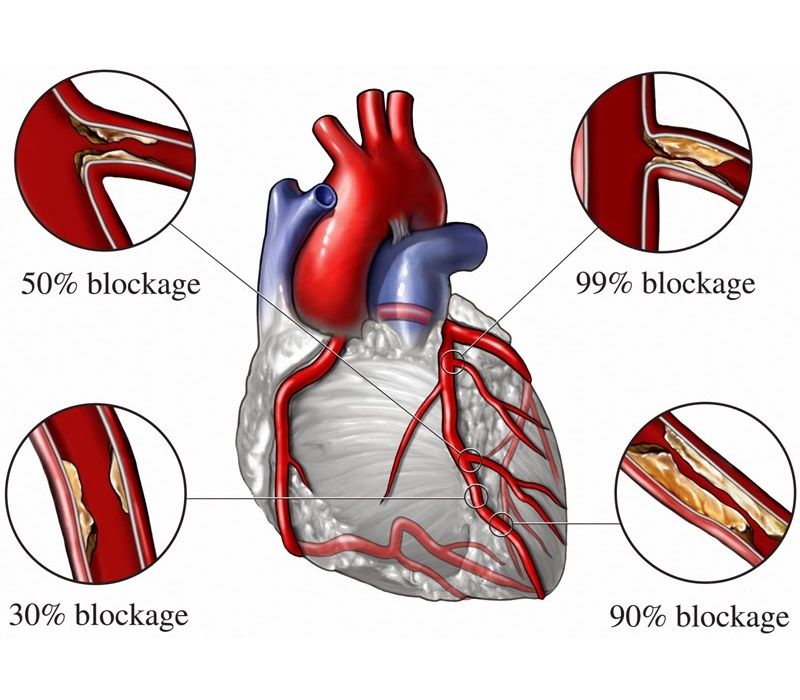 Angiography Karar haider abd al hussein
