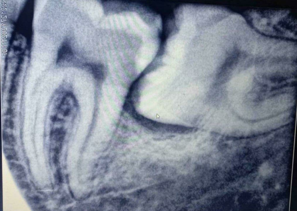 default image