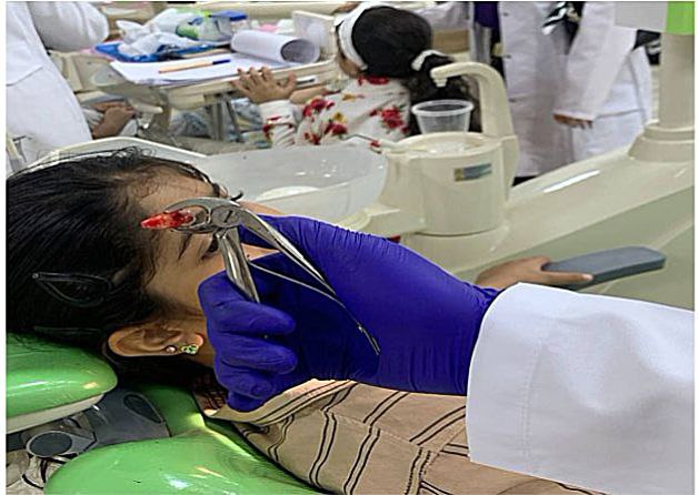 Performing a surgical extraction for a child in the pediatric dental clinic
