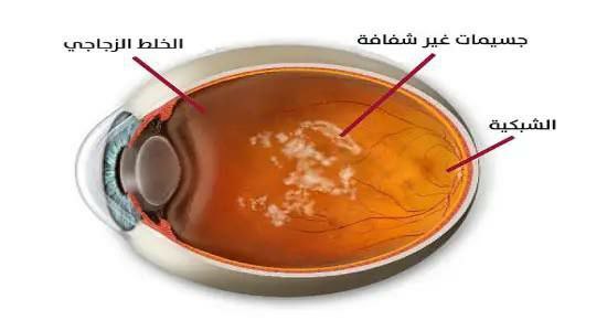 مقالة علمية للتدريسي م.م مهيمن سمير عارف بعنوان (ما هي الذبابة الطائرة؟)
