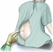 Spinal Anaesthesia