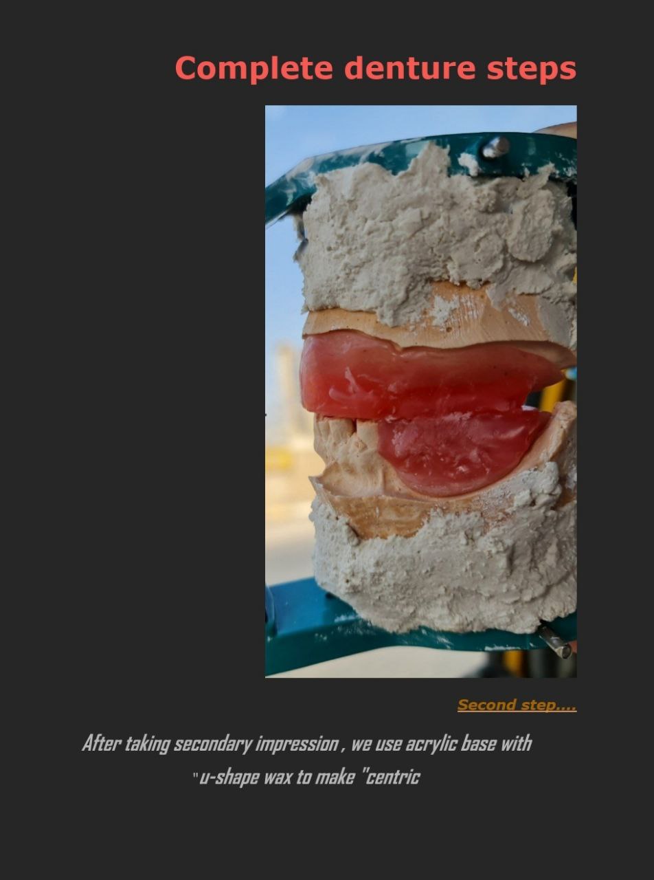 default image