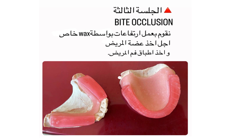 default image
