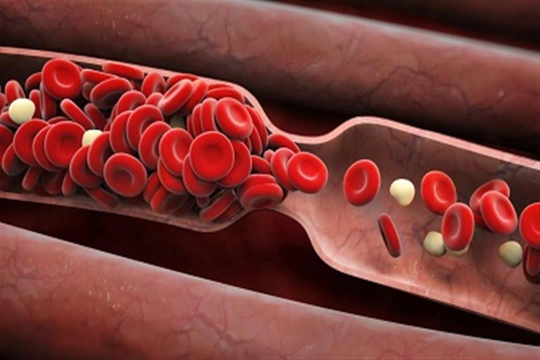 الهيموگلوبين Hemoglobin