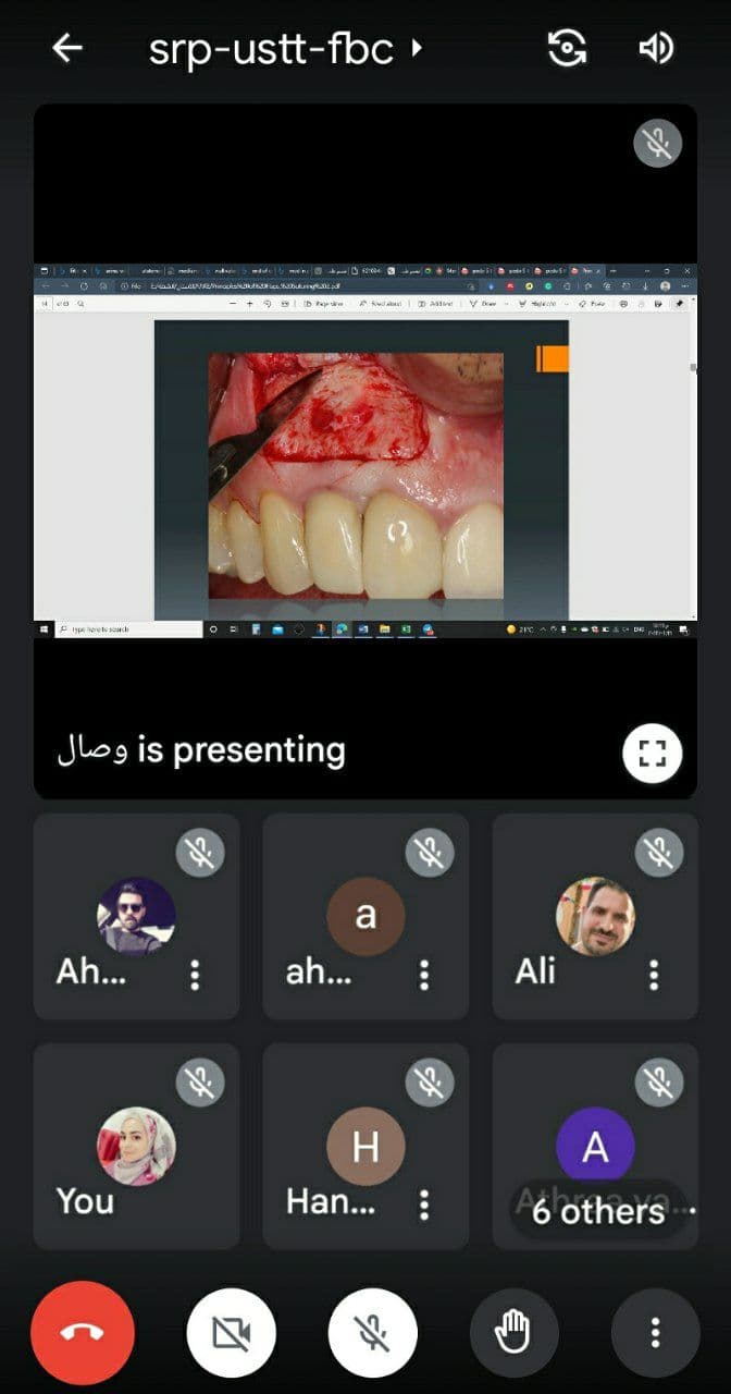 The Department of Dentistry holds an electronic scientific symposium entitled "PRINCIPLES OF, INCISIONS FLAPS & SUTURING"