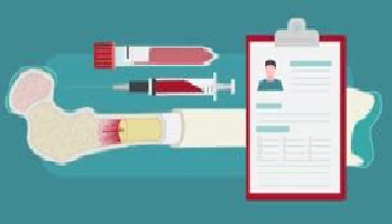 An Article entitled (Top misconceptions about bone marrow donation)