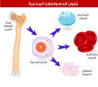 زراعة الخلايا الجذعية لمرضى السرطان للمعيدة  م. سارة حامد دانه