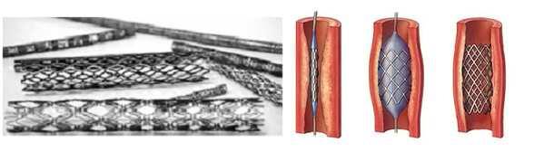 NiTi Shape Memory Alloys