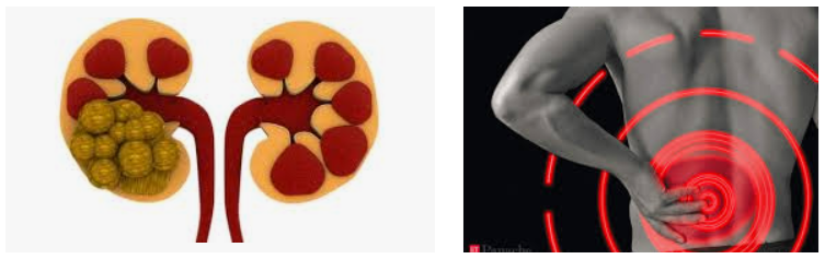 default image