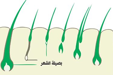 default image