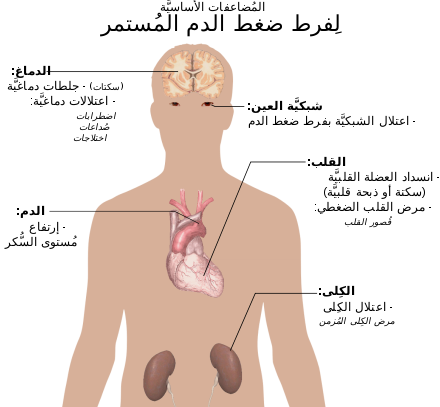default image