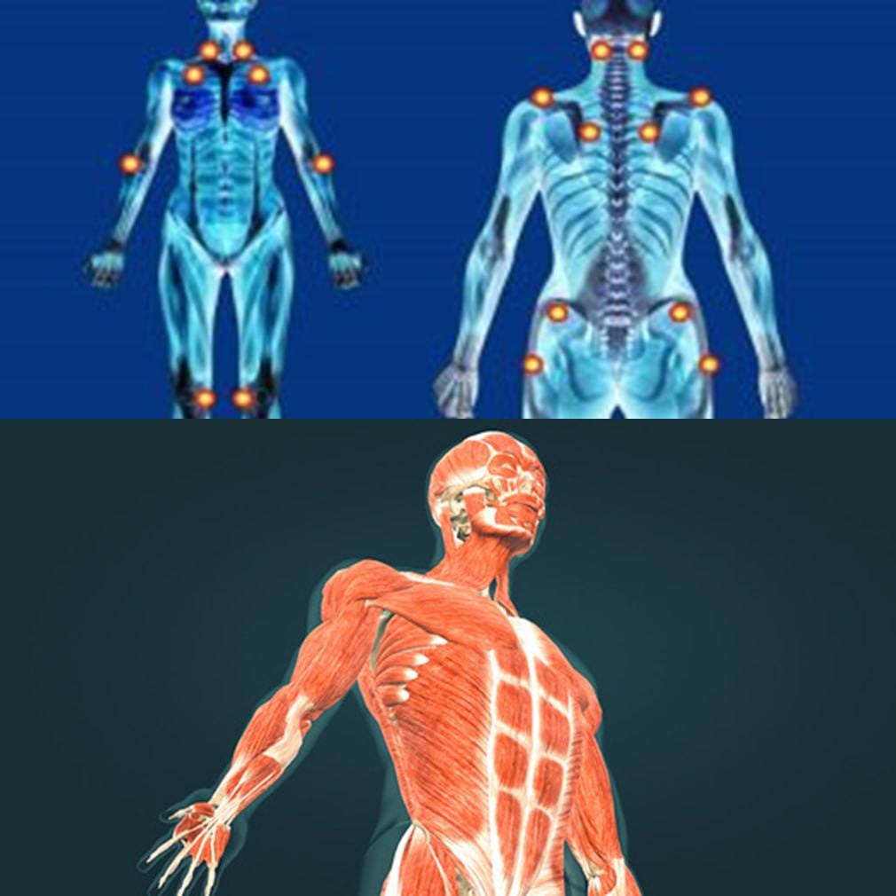 default image