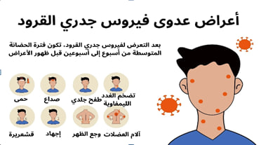 مقالة علمية ل(أ.د. حسنين خليل ابراهيم ) بعنوان"" جدري القرود""