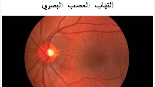 default image