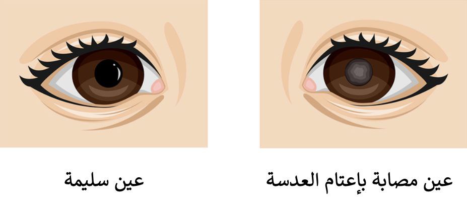 default image