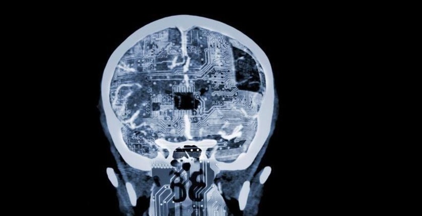 " The Role of Artificial Intelligence in Magnetic Resonance Imaging Diagnosis " BY DR MOHANED AHMED SAHIB