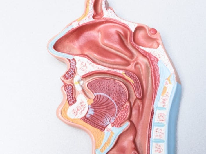 EFFECT OF PREMEDICATION WITH METOPROLOL ON BLEEDING IN NASAL SURGERY  By: Sajjad Saad salah