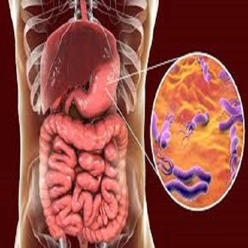 Helicobacter pylori