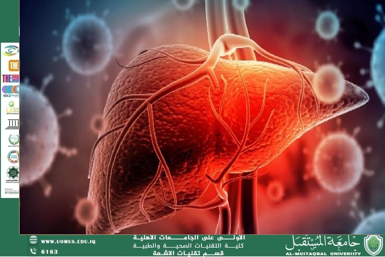 Article Title: Viral Hepatitis  By Dr. Fadel Sahib Al-hasnawi