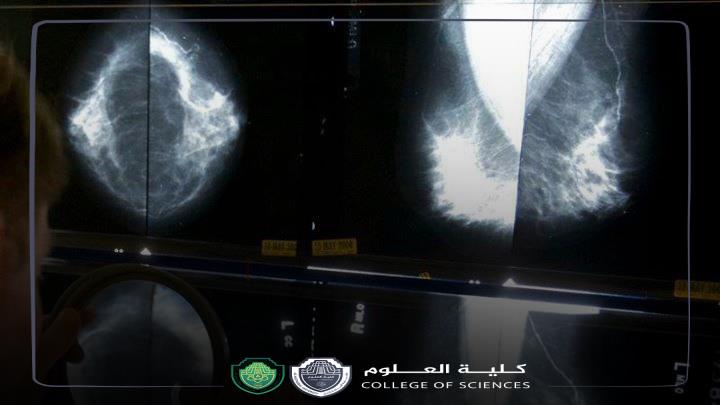 مقالة علمية للمعيدة ( مدلولة مؤيد فائق) بعنوان ""تأثير العلاج الإشعاعي على أنواع مختلفة من الأورام السرطانية""