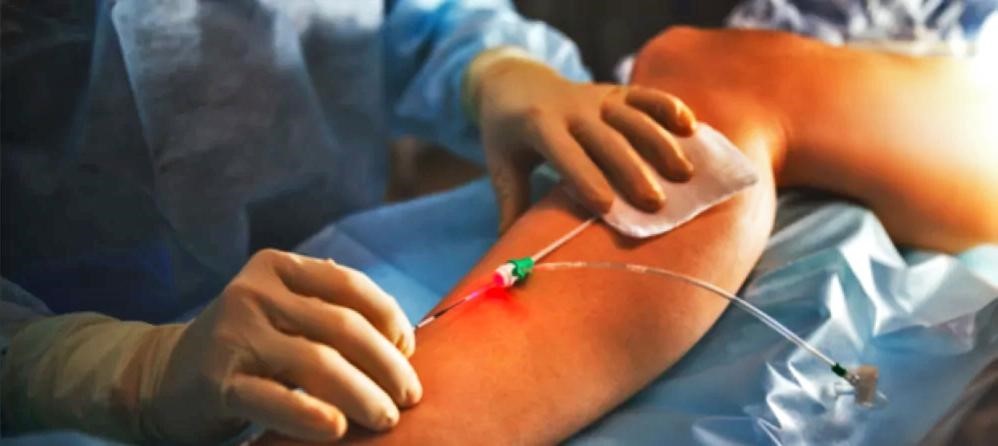 " كيفية علاج الدوالي بالليزر." بقلم المعيدة نبأ حسين حكمت           