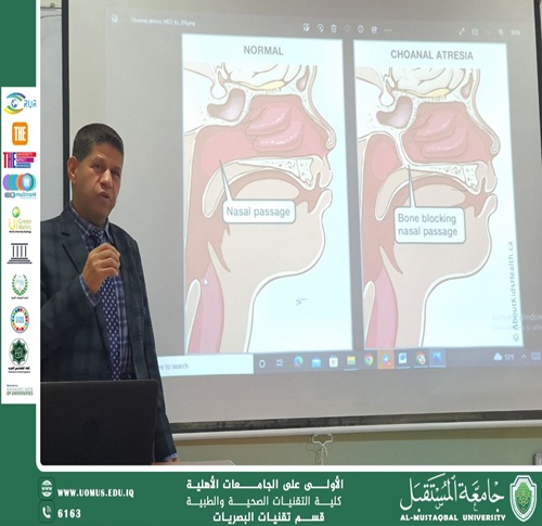 قسم تقنيات البصريات ينظم سمنارًا علميًا حول تأثير الصحة البصرية على الرفاه العام