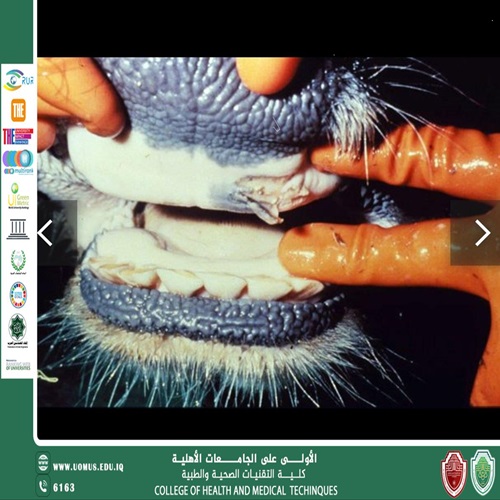 حمى قلاعية