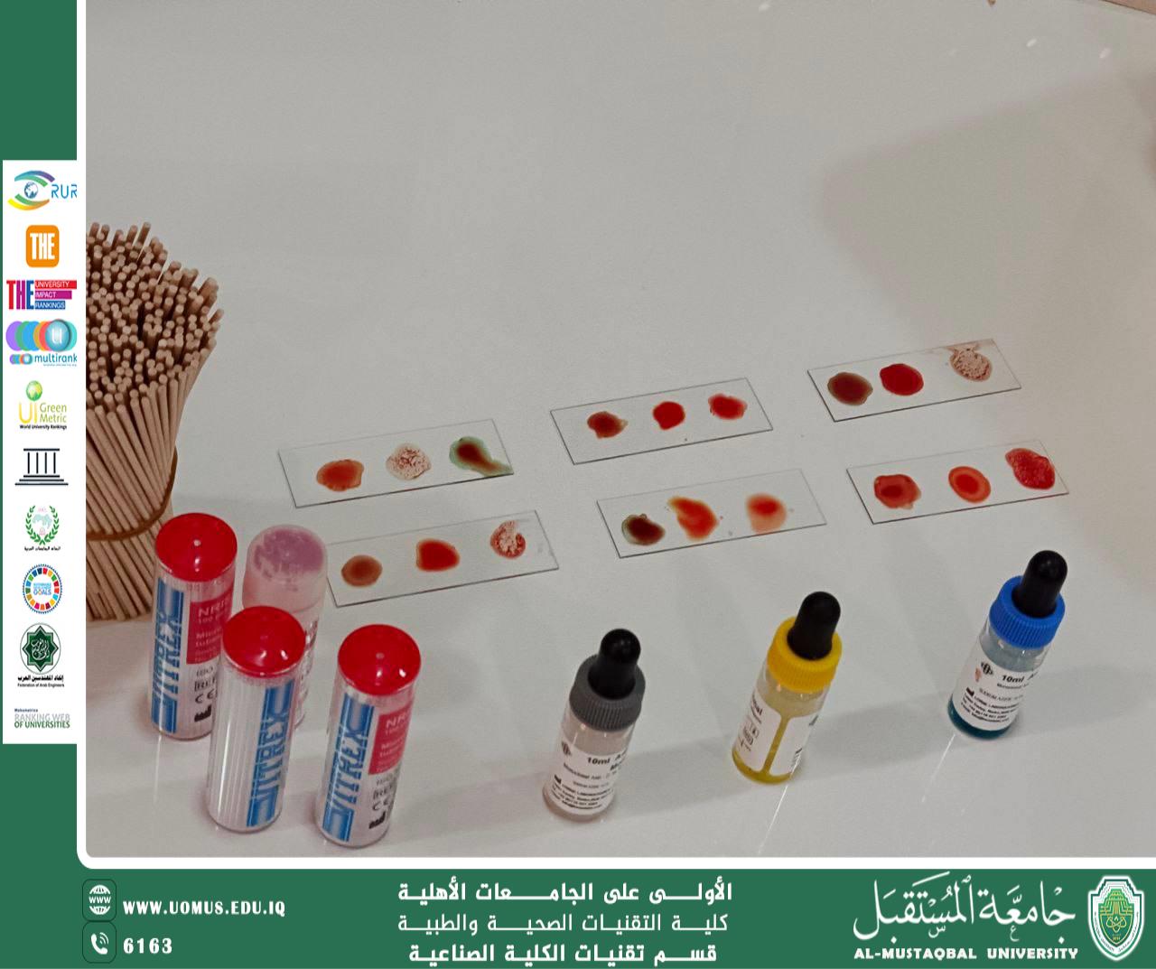 Practical Workshop on Blood Group Identification for Students of the Department of Industrial Kidney Technology