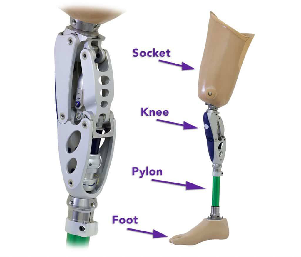 The importance of prosthetic limbs in the lives of amputees
