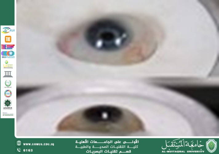 default image