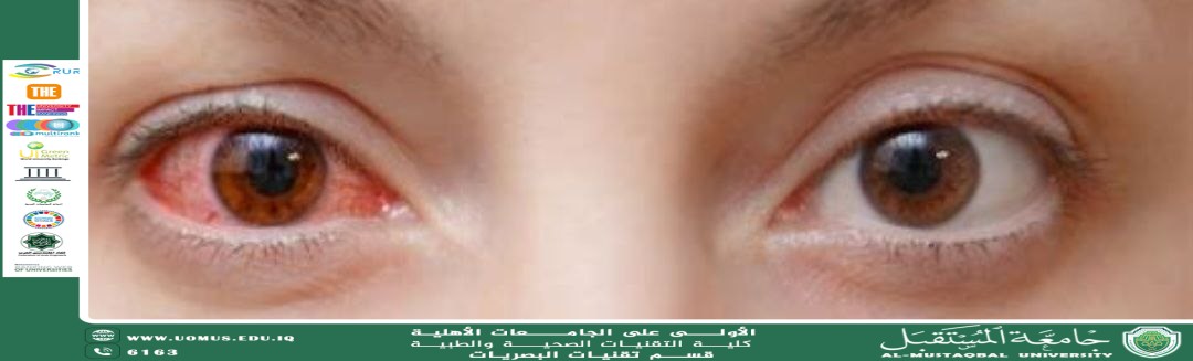 default image