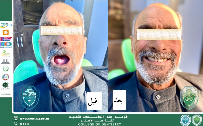 الطالب ضرغام حليم يبرز بإبداعه في عيادات طب الأسنان المختلفة
