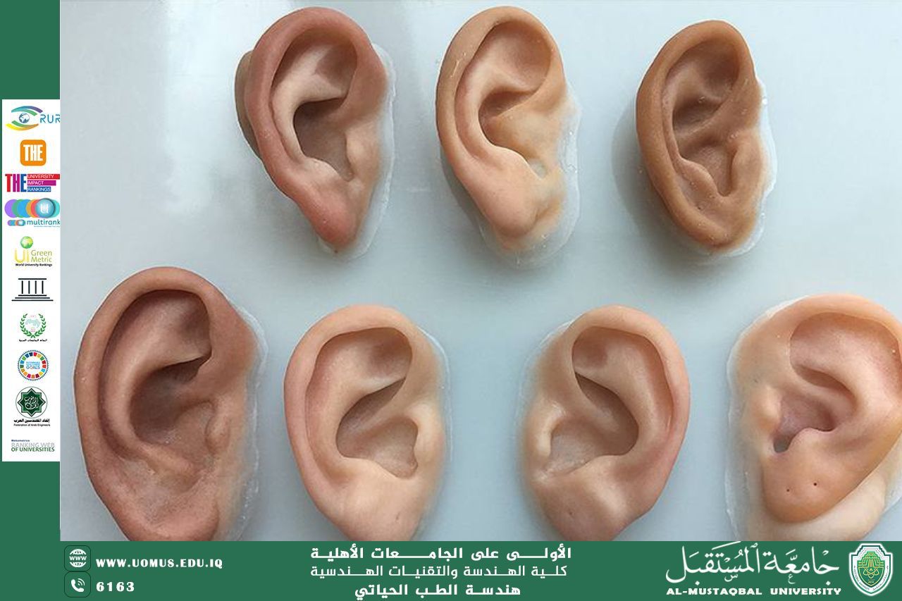 مقالة بعنوان "Silicone Prosthetic Ear"للمهندس محمد عبد الكريم رزوقي