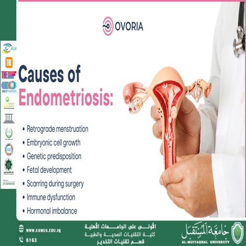 Causes of Endometriosis