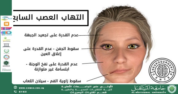 default image
