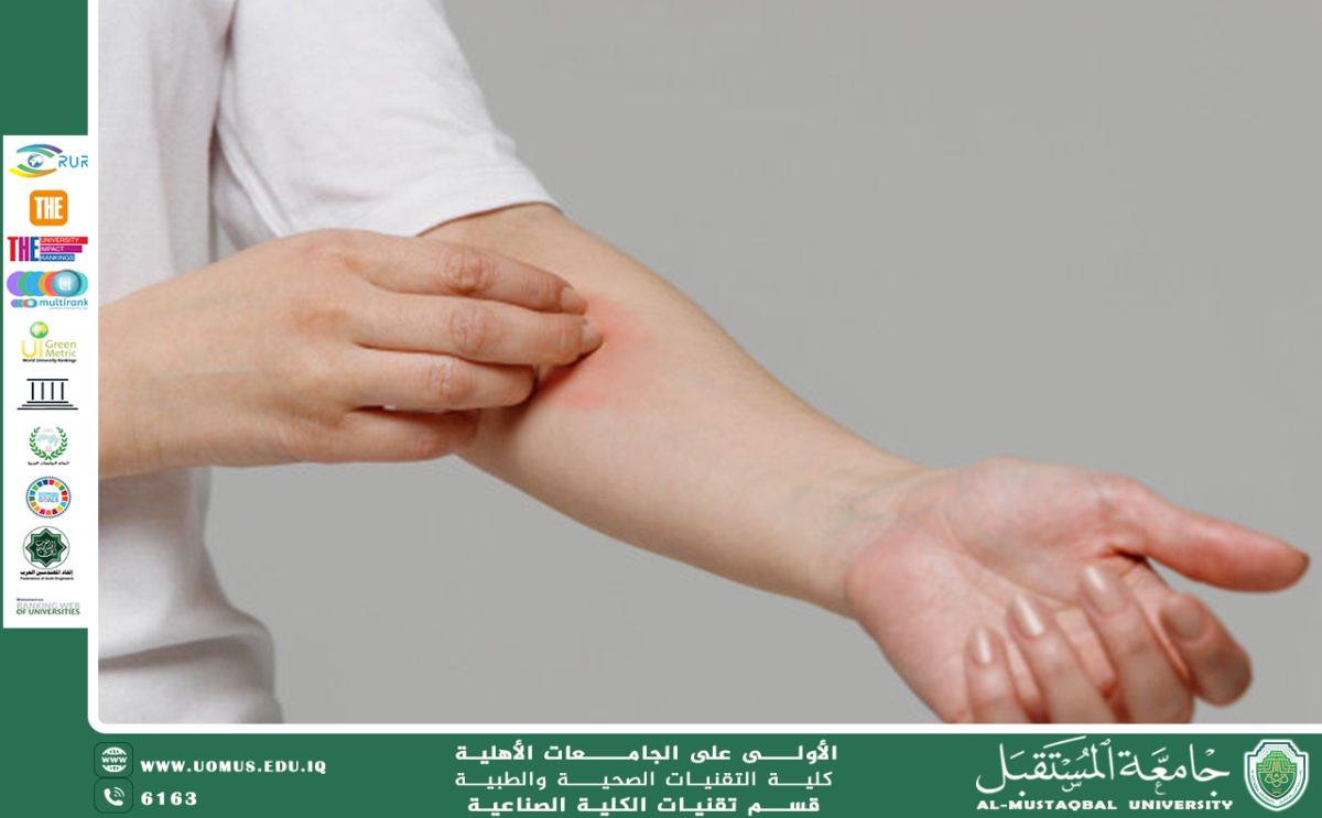 Hemodialysis and Its Effects on the Skin