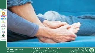 "Scientific Article by Lecturer Saja Jawad Ubaid Title Rheumatism