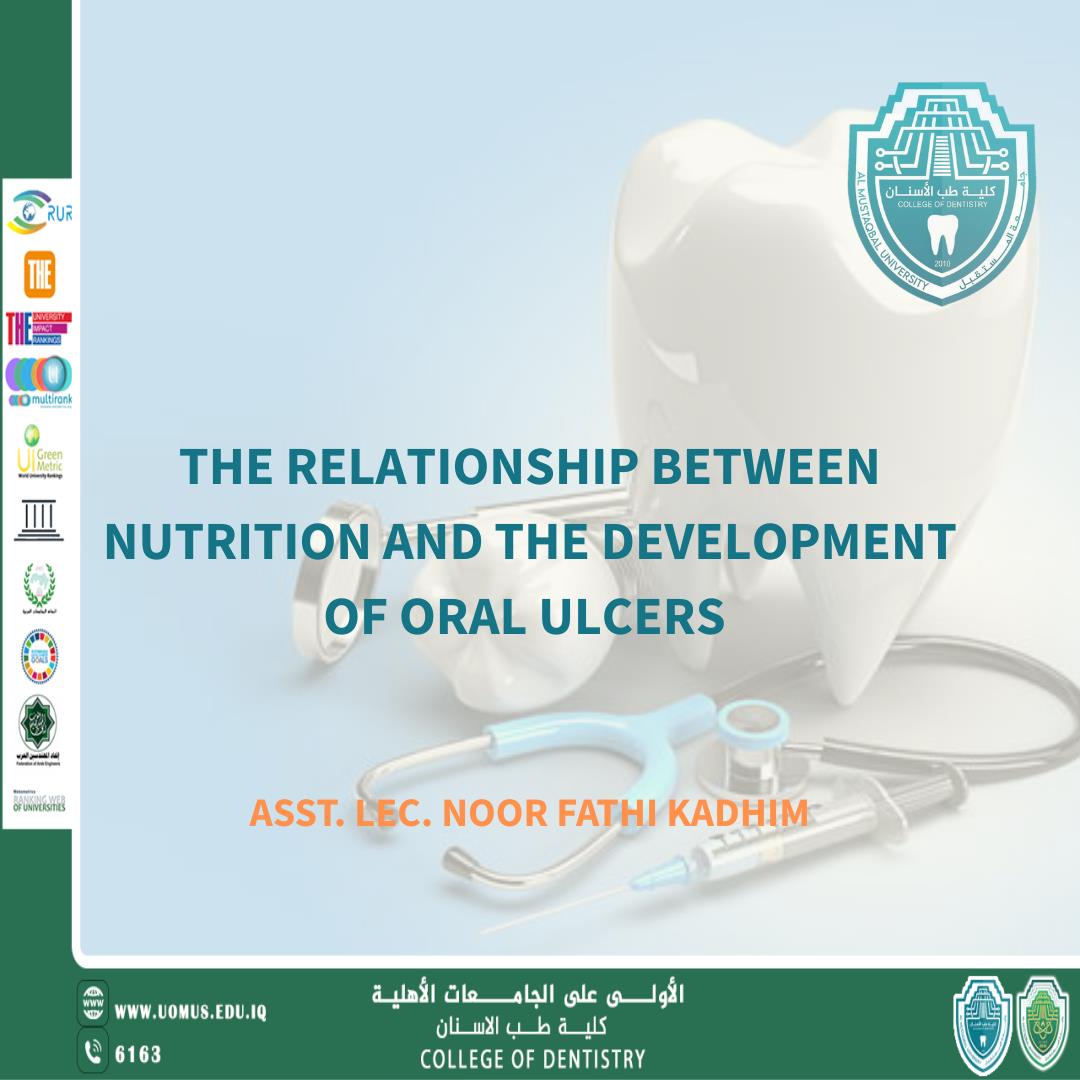 A new scientific article by Dr. Muayad Hashim titled: " The Relationship Between Nutrition and the Development of Oral Ulcers"
