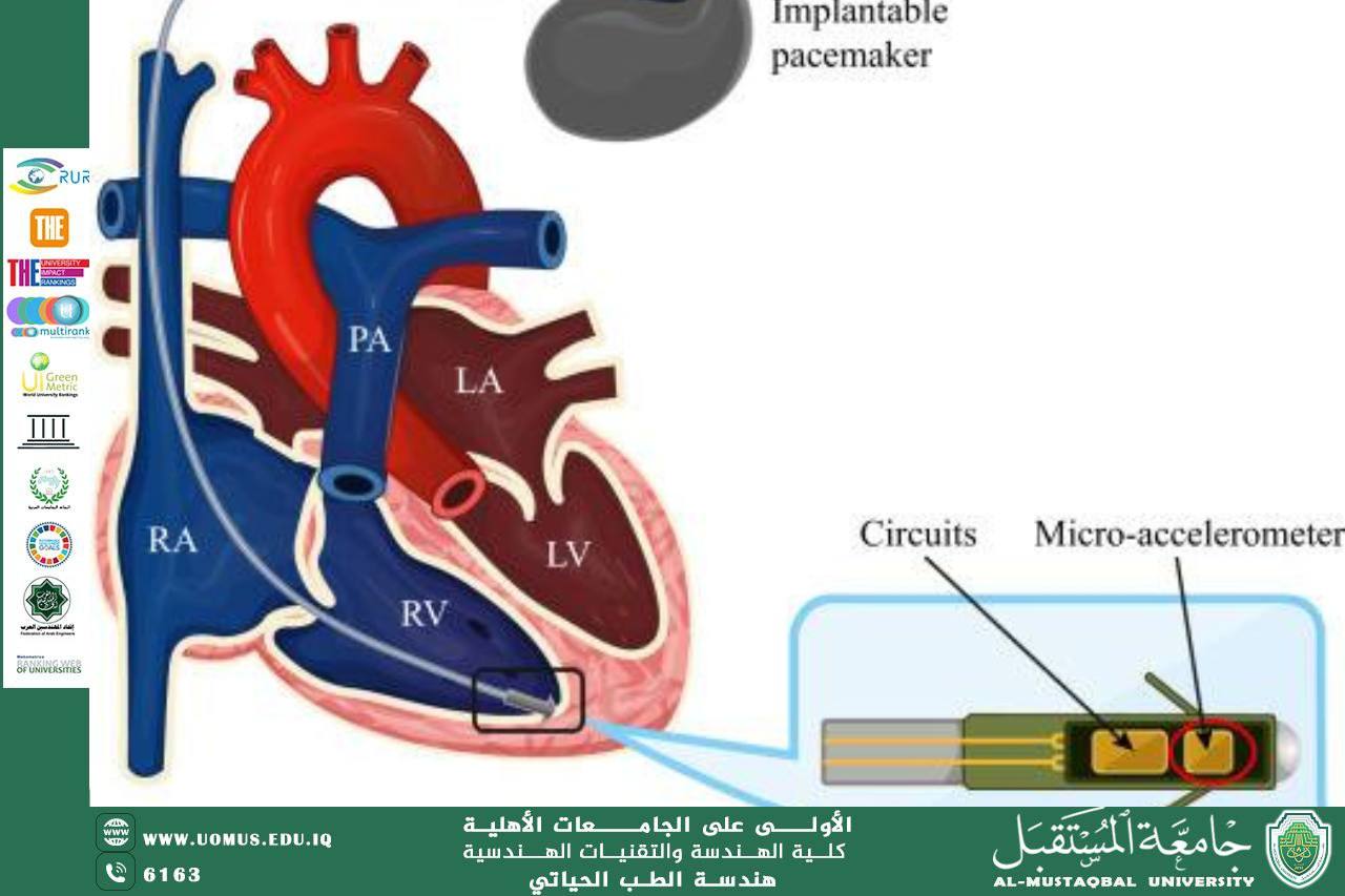  مقالة بعنوان"Implantable Sensorsللمهندس محمد عبد الكريم رزوقي