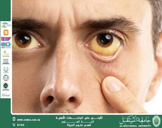 مقالة علمية للمعيدة بنين معن كريم بعنوان "الحمى الصفراء "