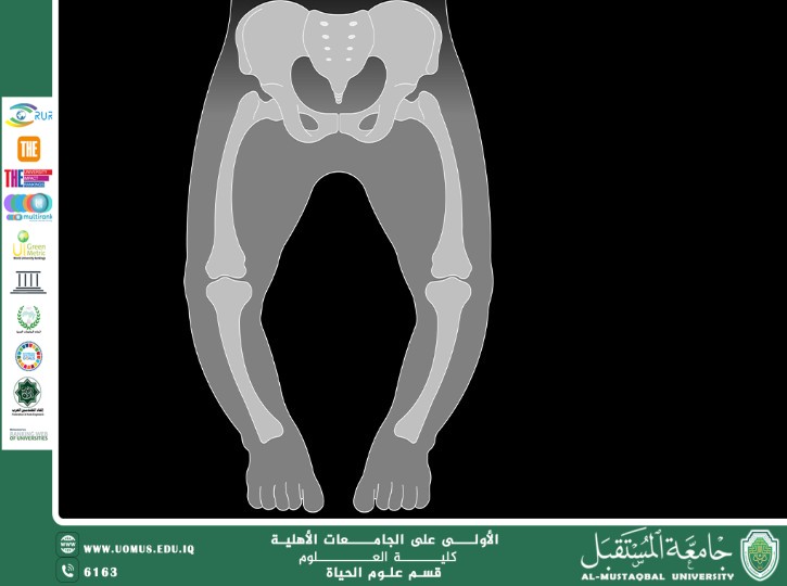 A scientific article by teaching assistant Banin Maan Karim entitled "Rickets"