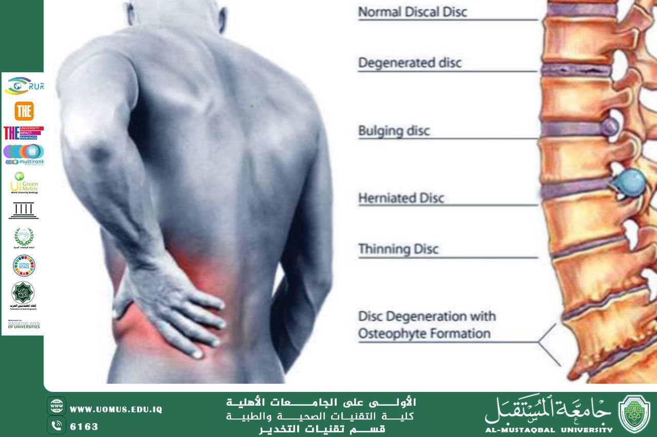 مقالة للاستاذ أسامة عزيز عن التخدير النخاعي وجراحة أسفل الظهر