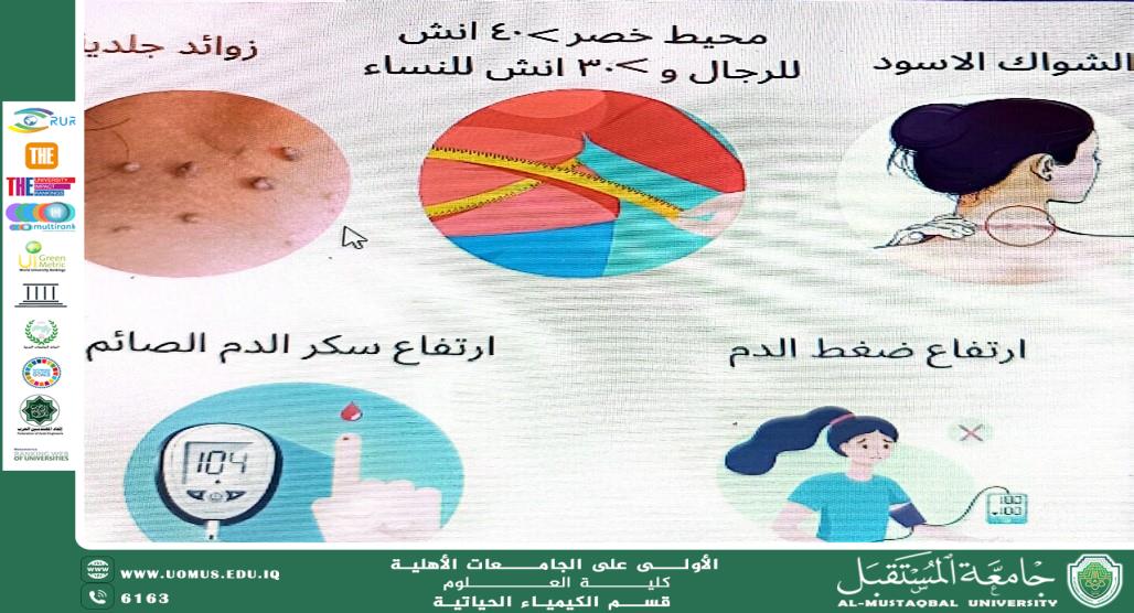 مقالة علمية للتدريسية م.د.داليا شاكر عبيده بعنوان مقاومة الإنسولين: مرض استقلابي يهدد الصحة العالمية ويتطلب استراتيجيات مستدامة لتحقيق أهداف التنمية المستدامة"